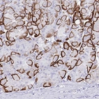 Immunohistochemical staining of human stomach shows moderate to strong membranous positivity in glandular cells.