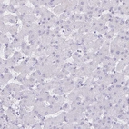 Immunohistochemical staining of human liver shows no positivity in hepatocytes as expected.