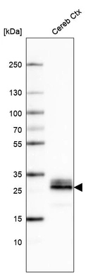 Western blot analysis in human cerebral cortex tissue.
