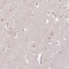 Immunohistochemical staining of human cerebral cortex shows weak cytoplasmic positivity in neurons.