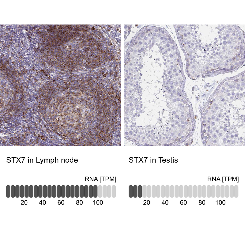 Anti-STX7 Recombinant Antibody