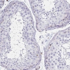 Immunohistochemical staining of human testis shows no positivity in cells in seminiferous ducts as expected.