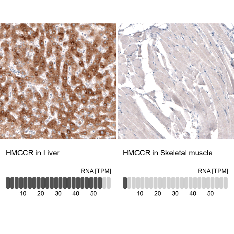 Anti-HMGCR Recombinant Antibody