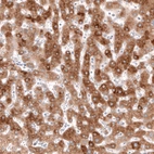 Immunohistochemical staining of human liver shows moderate cytoplasmic positivity in hepatocytes.