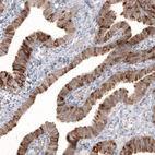 Immunohistochemical staining of human fallopian tube shows moderate to strong cytoplasmic positivity in glandular cells.