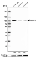 Western blot analysis in MCF-7 cells transfected with control siRNA, target specific siRNA probe #1 and #2, using Anti-HMGCR antibody. Remaining relative intensity is presented. Loading control: Anti-GAPDH.