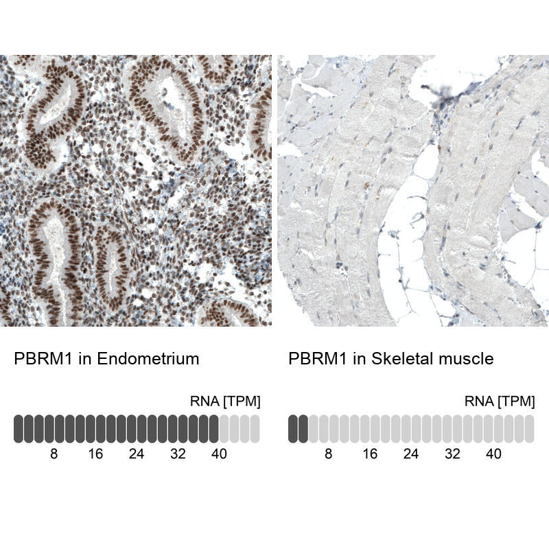 Anti-PBRM1 Recombinant Antibody