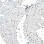 Immunohistochemical staining of human skeletal muscle shows no nuclear positivity in striated muscle fibers as expected.