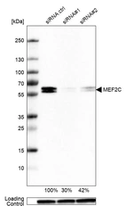 Western blot analysis in WM115 cells transfected with control siRNA, target specific siRNA probe #1 and #2, using Anti-MEF2C antibody. Remaining relative intensity is presented. Loading control: Anti-GAPDH.