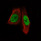 Immunofluorescence staining of RH-30 cells using the Anti-MEF2C monoclonal antibody, showing specific staining in the nucleoplasm in green. Microtubule- and nuclear probes are visualized in red and blue, respectively (where available).