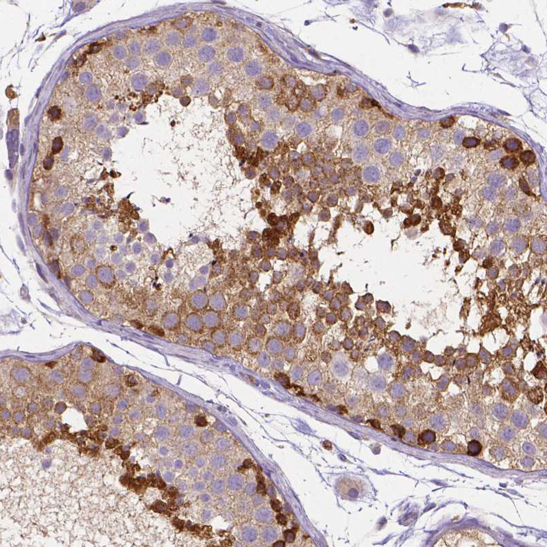 Anti-DICER1 Recombinant Antibody
