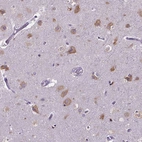 Immunohistochemical staining of human cerebral cortex shows moderate cytoplasmic positivity in neurons.