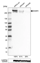 Western blot analysis in RT-4 cells transfected with control siRNA, target specific siRNA probe #1 and #2, using Anti-DICER1 antibody. Remaining relative intensity is presented. Loading control: Anti-GAPDH.