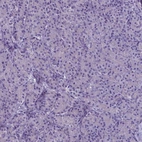 Immunohistochemical staining of human pancreas shows no positivity in exocrine glandular cells as expected.