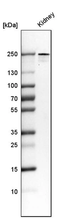 Western blot analysis in human kidney tissue.