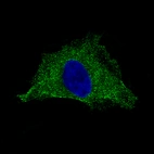 Immunofluorescence staining of HeLa cells using the Anti-PLA2R1 monoclonal antibody, showing specific staining in the cytosol and plasma membrane in green. Microtubule- and nuclear probes are visualized in red and blue, respectively (where available).