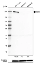 Western blot analysis in U-251MG cells transfected with control siRNA, target specific siRNA probe #1 and #2, using Anti-BRD4 antibody. Remaining relative intensity is presented. Loading control: Anti-GAPDH.