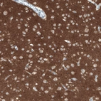 Immunohistochemical staining of human cerebral cortex shows strong positivity in neuropil.