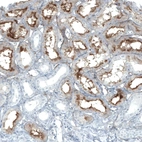 Immunohistochemical staining of human kidney shows strong positivity in apical membrane in cells in tubules.