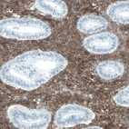 Immunohistochemical staining of human endometrium shows strong membranous positivity in stromal cells.