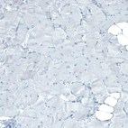 Immunohistochemical staining of human skeletal muscle shows no positivity in myocytes as expected.