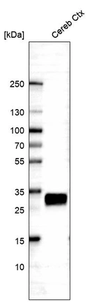Western blot analysis in human cerebral cortex tissue.