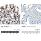 Anti-OCLN Recombinant Antibody