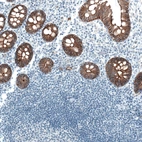 Immunohistochemical staining of human colon shows strong membranous positivity in glandular cells.