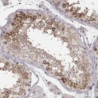 Immunohistochemical staining of human testis shows moderate to strong cytoplasmic positivity in a subset of cells in seminiferous ducts.