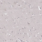 Immunohistochemical staining of human cerebral cortex shows no positivity in neurons as expected.