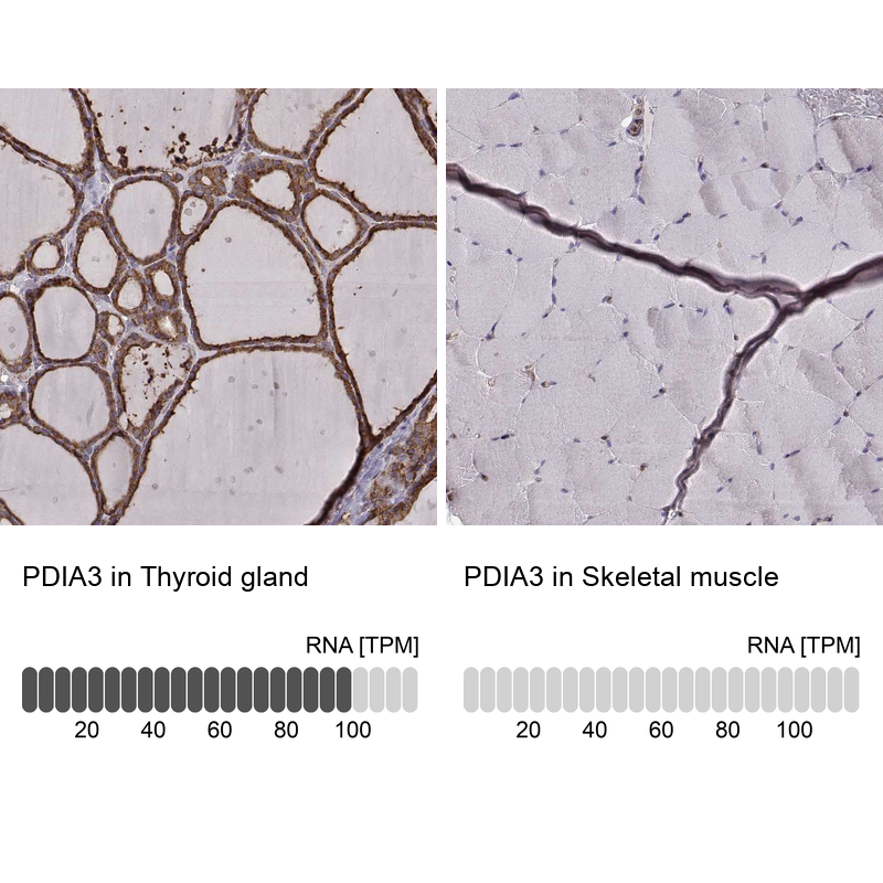 Anti-PDIA3 Recombinant Antibody