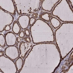 Immunohistochemical staining of human thyroid gland shows moderate to strong cytoplasmic positivity in glandular cells.