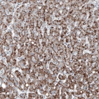 Immunohistochemical staining of human liver shows moderate granular cytoplasmic positivity in hepatocytes.