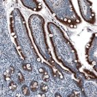 Immunohistochemical staining of human small intestine shows strong granular cytoplasmic positivity in glandular cells.