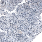Immunohistochemical staining of human pancreas shows weak granular cytoplasmic positivity in exocrine glandular cells.