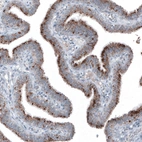 Immunohistochemical staining of human fallopian tube shows moderate granular cytoplasmic positivity in glandular cells.