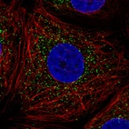 Immunofluorescence staining in MCF7 cell line with Anti-ABCD3 monoclonal antibody, showing specific staining of peroxisomes in green. Microtubule- and nuclear probes are visualized in red and blue respectively (where available).