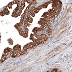 Immunohistochemical staining of human prostate shows strong cytoplasmic positivity in glandular cells.