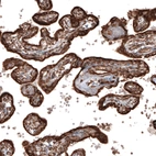 Immunohistochemical staining of human placenta shows strong cytoplasmic positivity in trophoblastic cells.