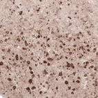 Immunohistochemical staining of human cerebral cortex shows strong cytoplasmic positivity in neurons.
