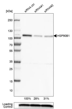 Western blot analysis in U-251MG cells transfected with control siRNA, target specific siRNA probe #1 and #2, using Anti-HSP90B1 antibody. Remaining relative intensity is presented. Loading control: Anti-PPIB.