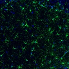 Immunofluorescence staining of rat brain shows strong positivity in astrocytes in the hippocampus.