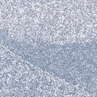 Immunohistochemical staining of human tonsil shows no positivity in lymphoid cells as expected.