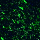 Immunofluorescence staining of rat basal forebrain shows strong positivity in myelinated neural fibers.