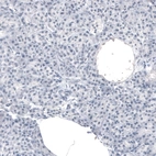 Immunohistochemical staining of human pancreas shows no positivity in exocrine glandular cells as expected.