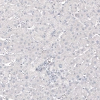 Immunohistochemical staining of human liver shows no positivity in hepatocytes as expected.