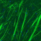Immunohistochemical staining of rat striatum shows strong positivity in myelinated neural processes.