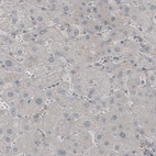 Immunohistochemical staining of human liver shows absence of immunoreactivity (negative control).