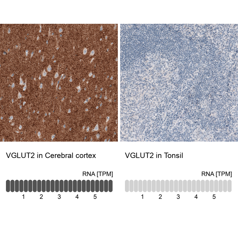 Anti-SLC17A6 Recombinant Antibody