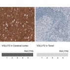 Anti-SLC17A6 Recombinant Antibody